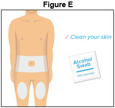 Figure E - Prefilled Syringe