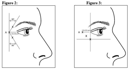 Botox Dosing Chart