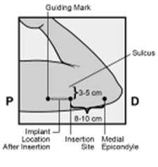 Figure 2a