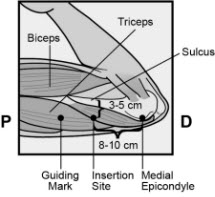 Figure 2b