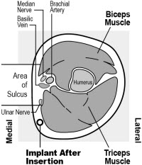 Figure 2c