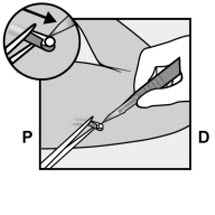 Figure 14