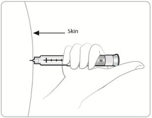 Figure P - 120mcg insert needle