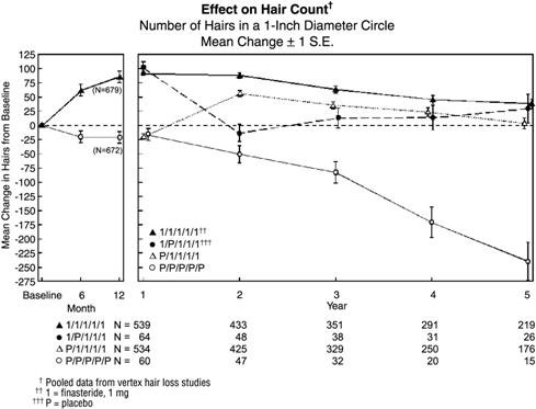 Time administration finasteride of