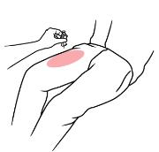 ZIMHITM is injected downwards, into the thigh, (as shown), through clothing if necessary.
