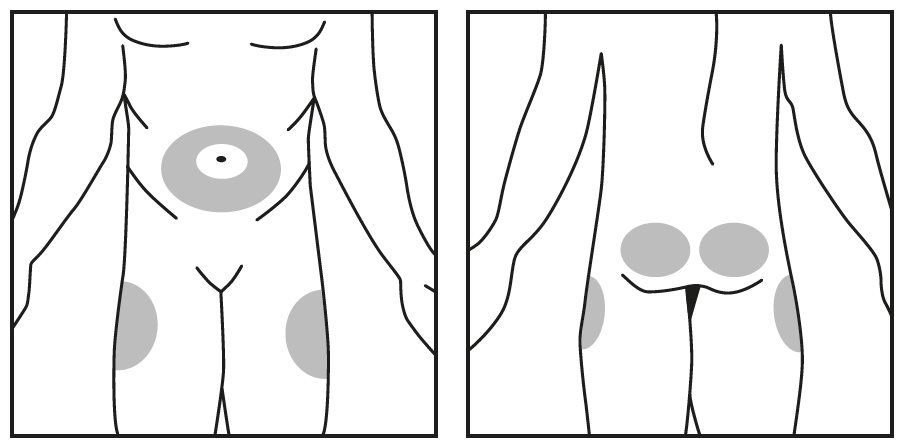 injection site figure