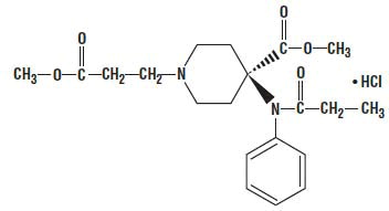 remif-struc-01.jpg