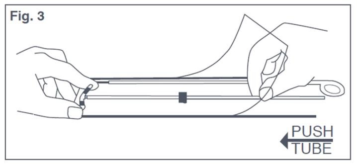 Figure 3: Bending T-Arms of Paraguard While in Sterile Packaging 