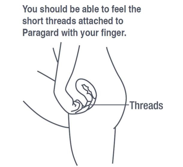 You should be able to feel the short threads attached to Paragard with your finger. 