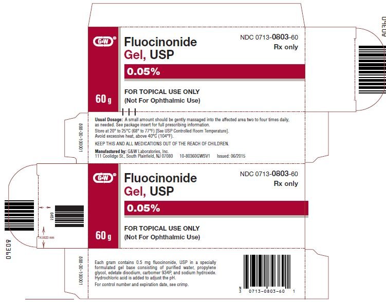 Psoriasis as related to fluocinonide topical pictures