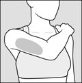figure-c-arms