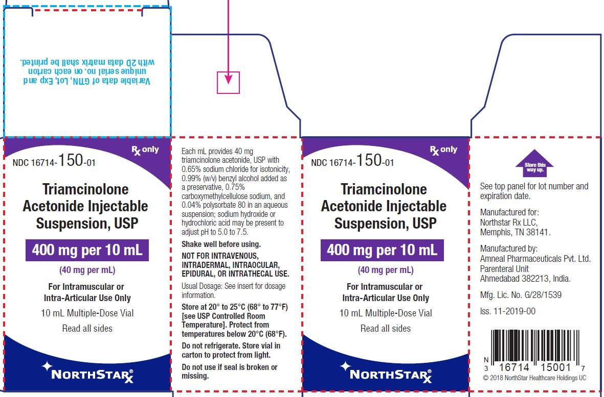 what is sub tenons triamcinolone injection