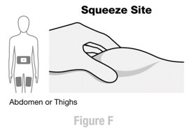 Figure F