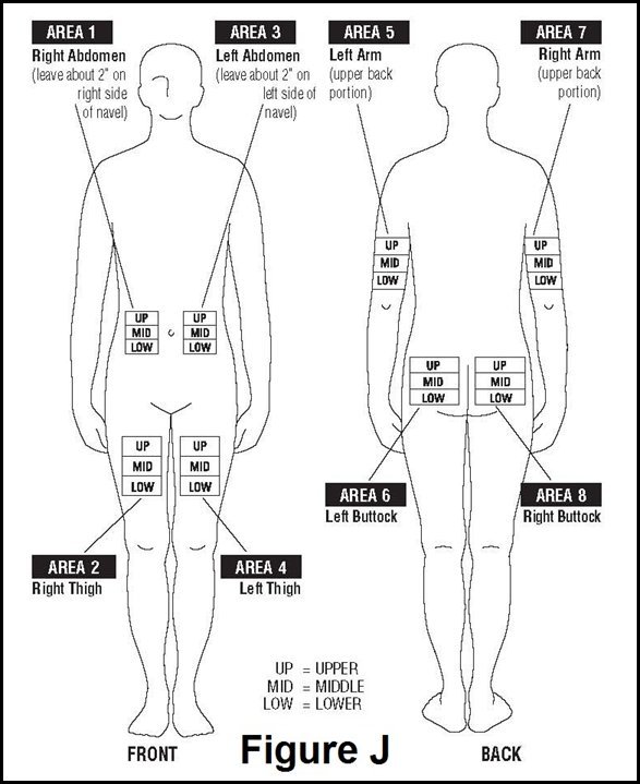 Diagram Of Injection Sites
