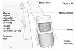 DUOPA
(carbidopa and levodopa) enteral suspension
