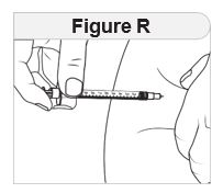 Figure R