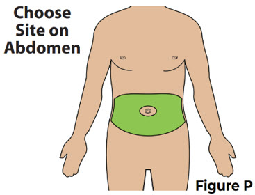 Figure P