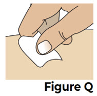 Figure Q