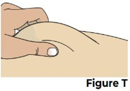 Figure T