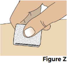 Figure Z
