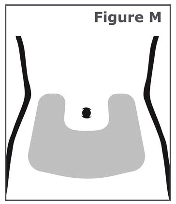 Figure M