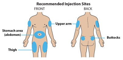 Guide to parts - Prefilled Syringe use.