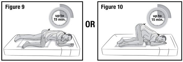 Figure 9 and Figure 10