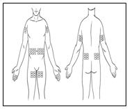 Hizentra Dosing Chart