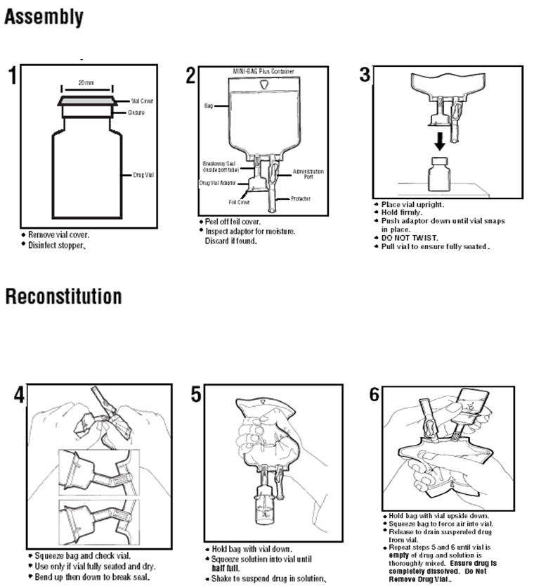 Feeding tube