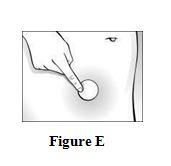Figure E