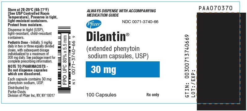 What can cause high dilantin levels