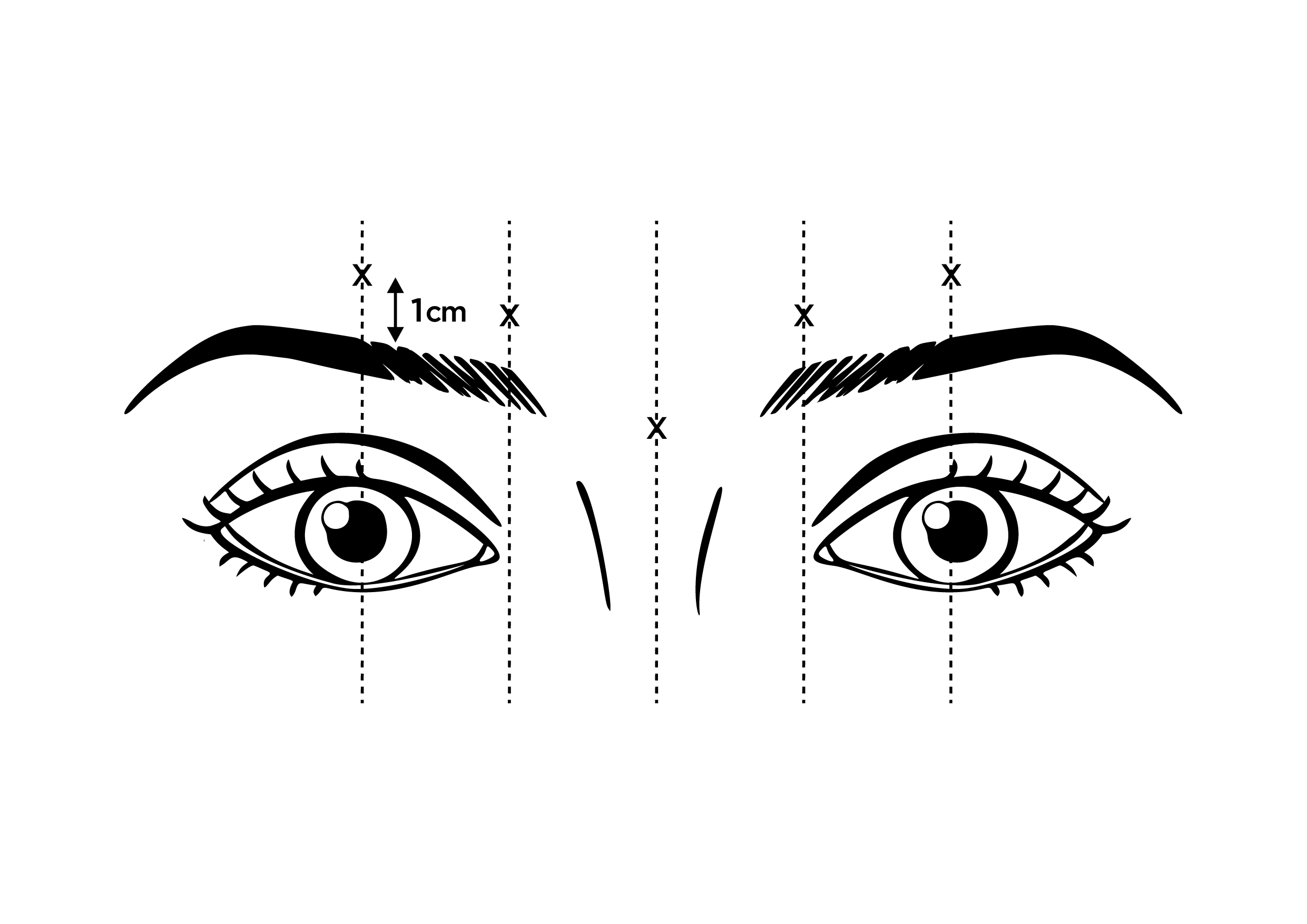 Figure 1: LETYBO Sites (x) for Intramuscular Injection
