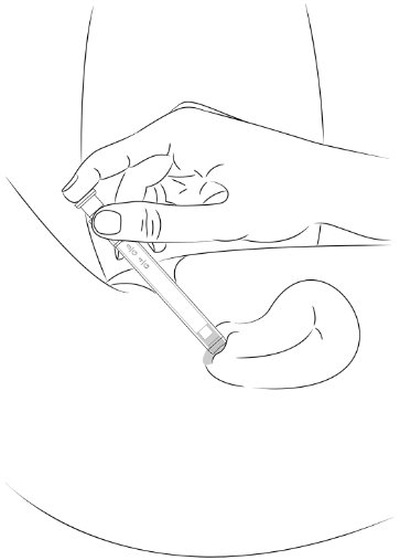 Figure E