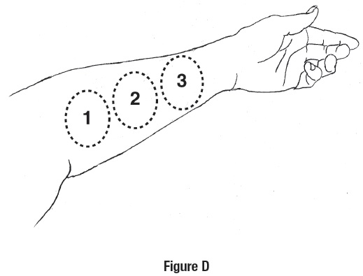 Figure D