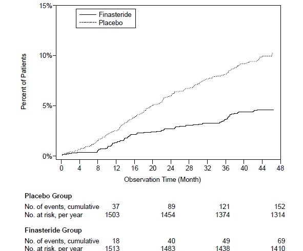 Finasteride-Fig.2