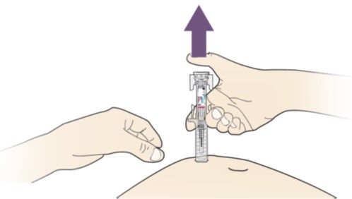 Instructions for Use Figure 09