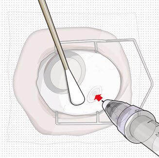 Figure 25