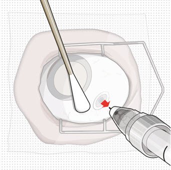 Figure 28