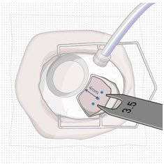 Figure 29