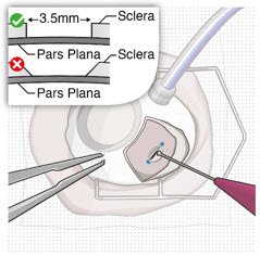 Figure30