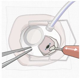 Figure 33