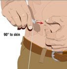 Choose the correct needle length to assure that GAMMAGARD LIQUID is delivered into the subcutaneous space.  Grasp the skin and pinch at least one inch of skin between two fingers.   Insert needle at a 90 degree angle with a darting motion into the subcutaneous tissue.  Secure the needle.