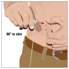 Choose the correct needle length to assure that GAMMAGARD LIQUID is delivered into the subcutaneous space. Grasp the skin and pinch at least one inch of skin between two fingers. Insert needle at a 90 degree angle with a darting motion into the subcutaneous tissue. Secure the needle.