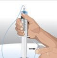 If using a syringe driver pump, attach the syringe filled with GAMMAGARD LIQUID to the needle set. On a hard surface, gently push down on the plunger to fill (prime) the pump tubing up to the needle hub. This will ensure that no air is left in the tubing and needle .