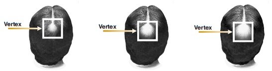 vertex