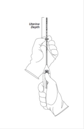 Setting Flange