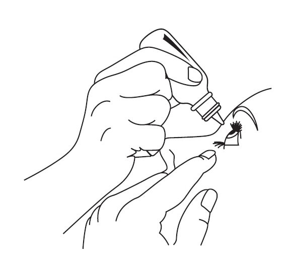 Timoptic-XE_IFU_Fig C