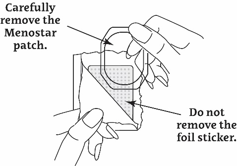 Removing patch