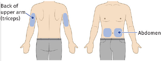 image 3 - UDENYCA ONBODY injector - OBI healthcare provider instructions for use