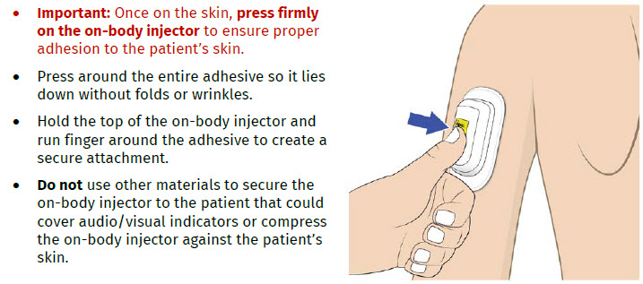 image 15 - UDENYCA ONBODY injector - OBI healthcare provider instructions for use